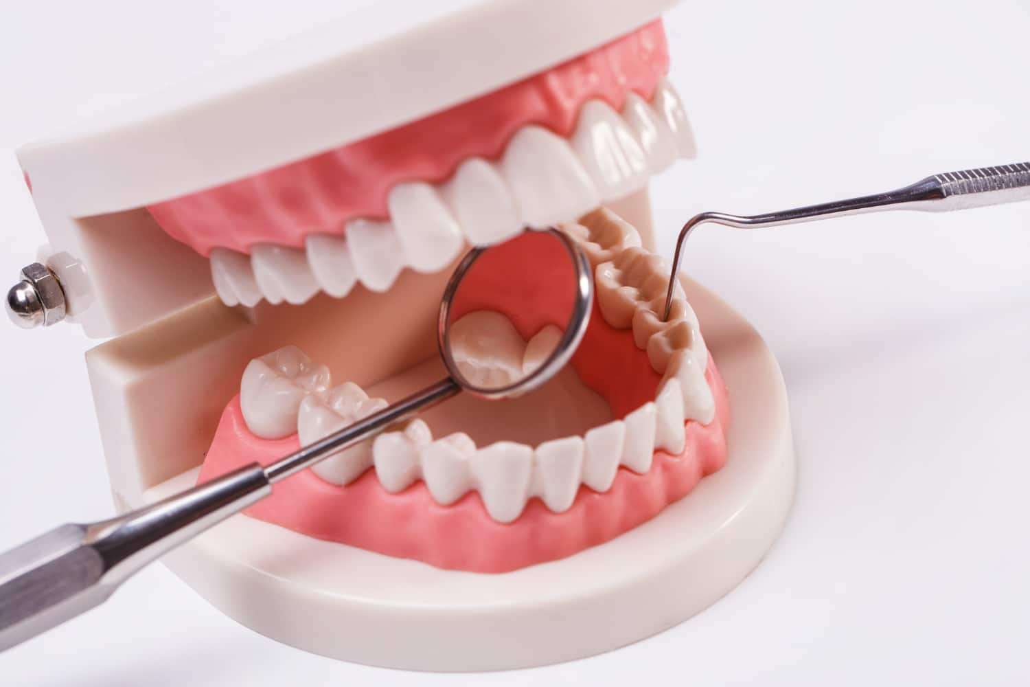 Dental Implants